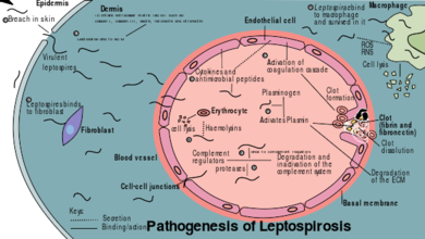 Diagram showing the pathogenesis of leptospirosis