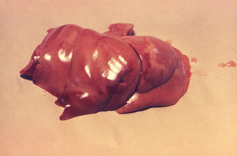 File:Liver of an unknown animal infected with leptospirosis.png